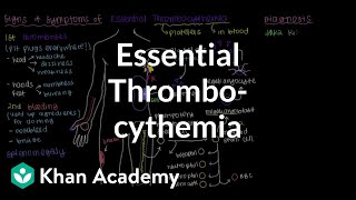 What is primary myelofibrosis  Hematologic System Diseases  NCLEXRN  Khan Academy [upl. by Lednik477]