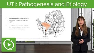 UTI Pathogenesis and Etiology with Case – Nephrology  Lecturio [upl. by Macnamara]