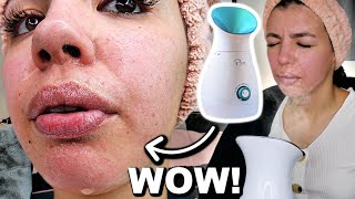 I Tested The Best FACIAL STEAMER On Amazon [upl. by Remat]