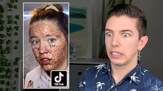 Specialist Reacts to Skin Care TikTok FAILS [upl. by Tiffie185]