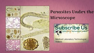 Parasites Under The Microscope [upl. by Kiyoshi787]