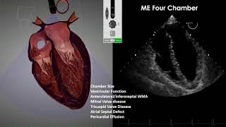 Transesophageal Echocardiography TEE Imaging [upl. by Enelie93]