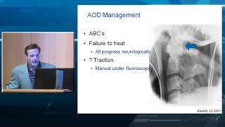 Occipital Cervical Fusion Indications and Techniques [upl. by Annaig]