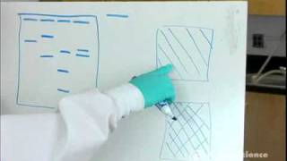 Electrophoresis How to Read Results [upl. by Annal]