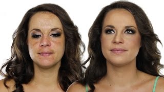 How To Cover Hyperpigmentation  Skin Pigmentation Using MakeUp  Shonagh Scott  ShowMe MakeUp [upl. by Dorris522]