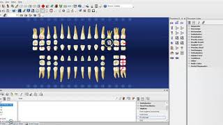 Hard Tissue Charting on Dentrix [upl. by Yeslah]