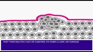 How Cancer Develops amp Mutation [upl. by Bautram]