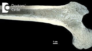 Osteomyelitis clinical features and diagnosis [upl. by Arries]