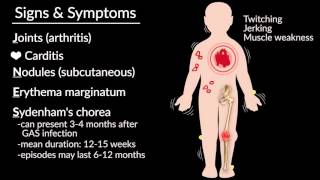 Acute Rheumatic Fever by E Rusingiza  OPENPediatrics [upl. by Aneekal]