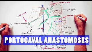 Portocaval Anastomoses  ANATOMY Tutorial [upl. by Wetzell]