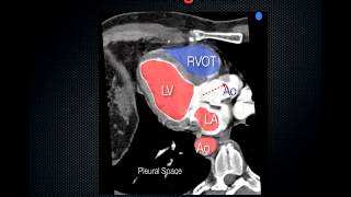 Understanding Echo Standard Imaging Views [upl. by Rosenstein]