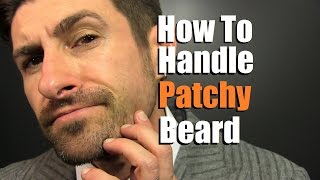 How To Deal With A Patchy Beard  Bald Spot Reduction Tips [upl. by Enyleuqcaj]