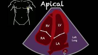 Part 2 Comprehensive TTE in Adults Webinar [upl. by Eiram]