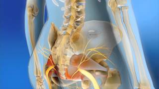 Sacral Neuromodulation  MOA Animation [upl. by Arielle]