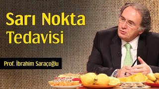 Sarı Nokta Tedavisi  Prof İbrahim Saraçoğlu [upl. by Estus]