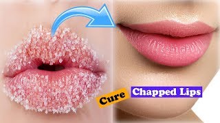 How to Cure Chapped Dry Lips In 5 Minutes [upl. by Shaikh]