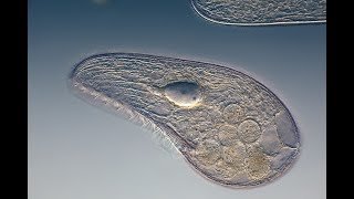 Microbiology of Eukaryotes Protozoa [upl. by Juster]