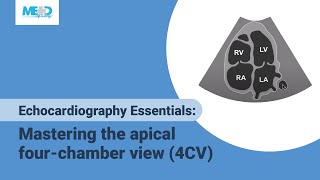 Calculating the aortic valve area [upl. by Cowen798]