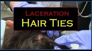 Laceration Hair Ties [upl. by Kasper717]