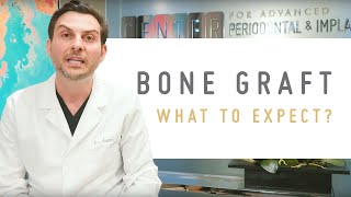 Bone Graft Procedure What to expect [upl. by Sudnor535]