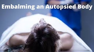 Embalming an autopsied body [upl. by Notsur]