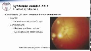 Candida Systemic Candidiasis [upl. by Ayala50]