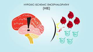 HypoxicIschemic Encephalopathy About Treatments amp Causes [upl. by Bautista]