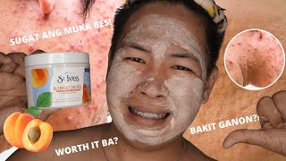 Get That Deep Clean Apricot Face Scrub  St Ives [upl. by Naehgem]