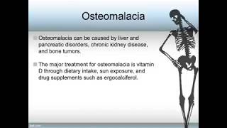 Osteroporosis and Osteomalacia [upl. by Josi]