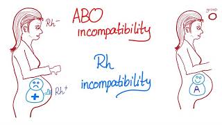 ABO incompatibility vs Rh incompatibility [upl. by Territus]