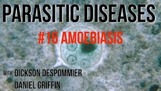 Parasitic Diseases Lectures 16 Amoebiasis [upl. by Jaymie]