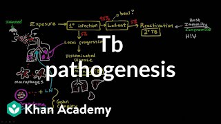 TB pathogenesis  Infectious diseases  NCLEXRN  Khan Academy [upl. by Yelena]