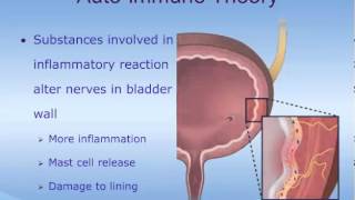 Understanding Interstitial Cystitis IC [upl. by China]