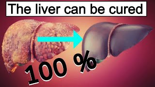 Fatty liver diet 7 best foods 🍎 for fatty liver How to reduce fatty liver [upl. by Alviani]