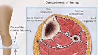 What is Compartment Syndrome  TheNurseNinja [upl. by Eihpos]