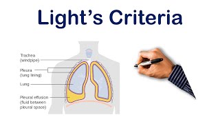 Pleural Effusion Lights Criteria  USMLE STEP COMLEX NCLEX [upl. by Tyika753]