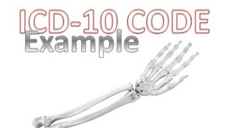 ICD 10 Basic Overview and Format [upl. by Sinnoda694]