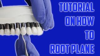 Dental Root Planing 101  StepbyStep [upl. by Ailgna471]