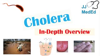 Cholera Vibrio Cholerae Pathophysiology Risk Factors Symptoms Diagnosis and Treatment [upl. by Aileen]