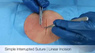 Hand Lac Suture Removal by Dr Gonzo More Houston Rain [upl. by Itnahsa710]