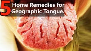 How to Clean Your Tongue  Benefits of Tongue Scraping [upl. by Selrahcnhoj]