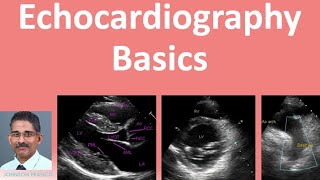 Echocardiography Basics [upl. by Annaihr]