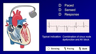 Introduction to ICD10 Coding [upl. by Norret]