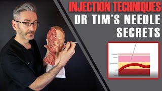 Injection Techniques Best Angles Depths How To Aspirate amp Stabilise Aesthetics Mastery Show [upl. by Rabkin428]