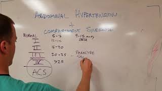 Abdominal Compartment Syndrome and Abdominal Hypertension [upl. by Hertzfeld]