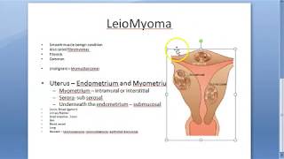 Pelvic Inflammatory Disease PID  ObGyn Lectures  NEET PG 2021  Dr Shonali Chandra [upl. by Ainevul]