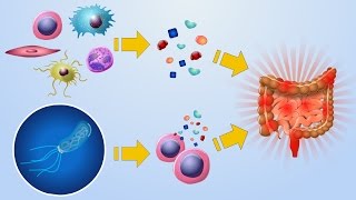 Etiology of IBD [upl. by Nabi]