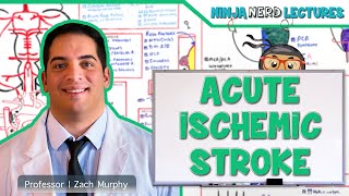 Acute Ischemic Stroke Etiology Pathophysiology Clinical Features Diagnostics Treatment [upl. by Arotak]