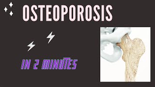 Osteoporosis in 2 mins [upl. by Bradman73]