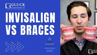 Invisalign Cost and Effectiveness [upl. by Girardi]